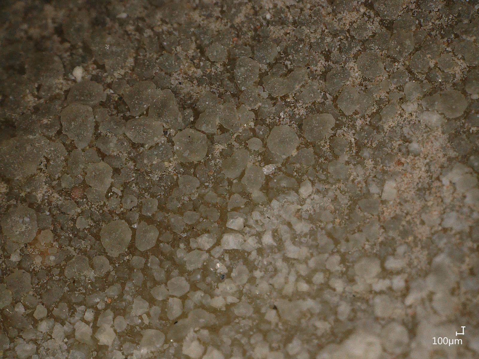 Croûte noire vue au microscope 3D